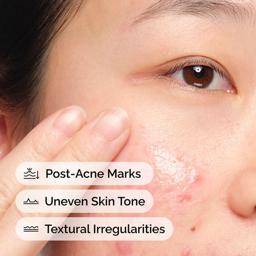 Aloe + NAG Solution Targeted Serum Care L2