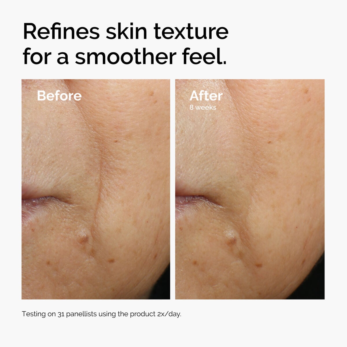 Caffeine + Escin Face Serum Targeted Serum Care E2