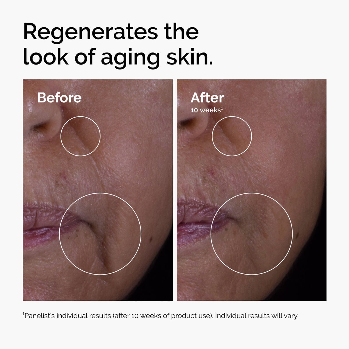 GF Solution Targeted Serum Care J5