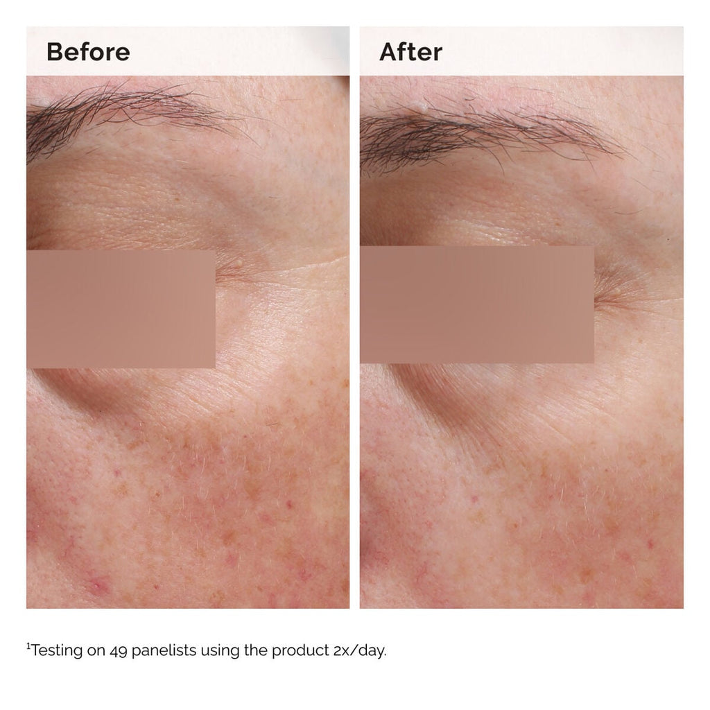 Niacinamide Face and Body Emulsion Targeted Serum Care N6
