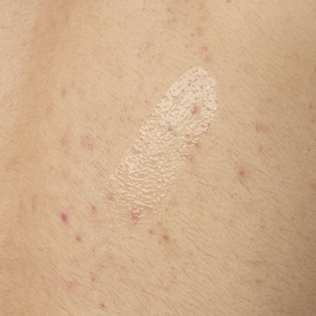 Salicylic Acid Body Serum Targeted Serum Care I8