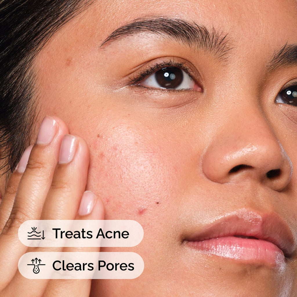 Salicylic Acid Solution Targeted Serum Care I2