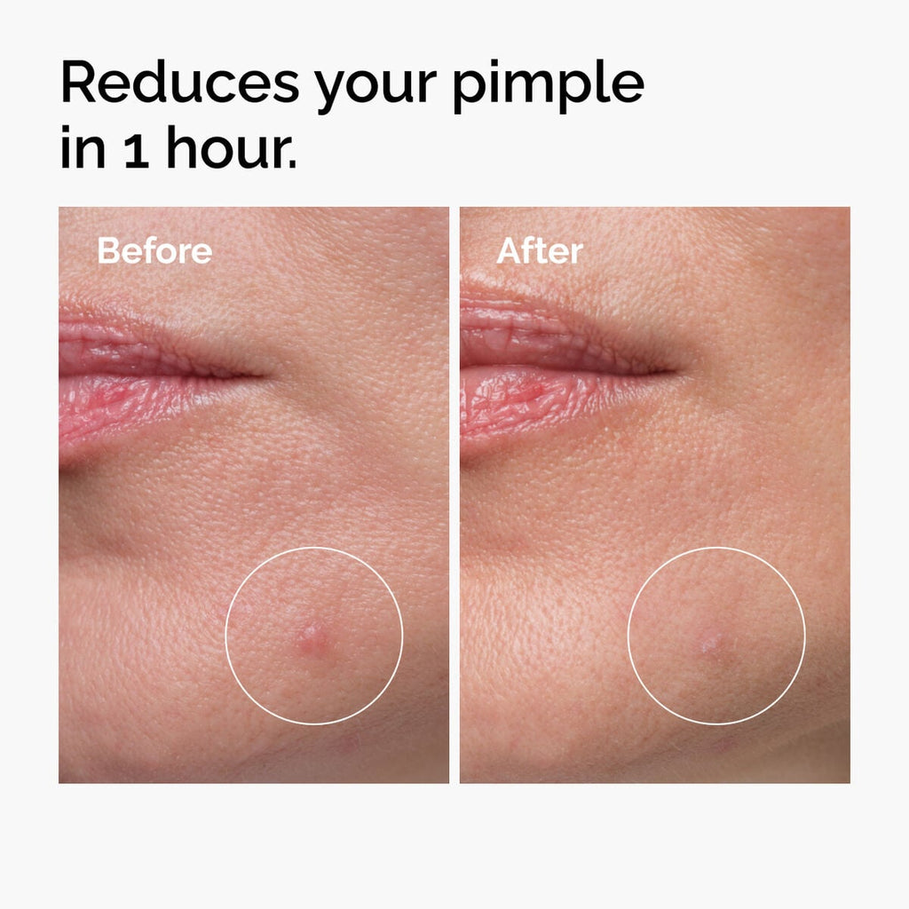 Sulfur Powder-to-Cream Concentrate Targeted Serum Care W2